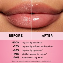 LAWLESS Forget the Filler Lip Mask - Sweet Dreams - Premium Overnight Lip Plumping Treatment with Natural Ingredients Designed to Plump, Hydrate, and Smooth Lips - 0.28 oz LAWLESS Forget the Filler Lip Mask - Sweet Dreams - Premium Overnight Lip Plumping Treatment with Natural Ingredients Designed to Plump, Hydrate, and Smooth Lips - 0.28 oz