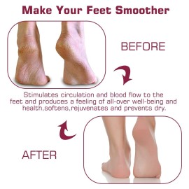 Shower Foot Scrubber Mat Back Washer Back Exfoliating Bath Wash Pad Wall Mounted Slip Suction Cups Foot Scrubber for Use in Shower Cups Foot Cleaner for Men and Women Shower Foot Scrubber Mat Back Washer Back Exfoliating Bath Wash Pad Wall Mounted Slip Suction Cups Foot Scrubber for Use in Shower Cups Foot Cleaner for Men and Women