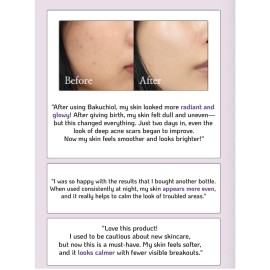 Korean Bakuchiol Concentrate Mix 2 Drops In Any Step of Your Skin Care Routine Retinol Alternative Non GMO Vegan Certificate Safe Natural Botanical Antioxidant Cold Pressed 10000ppm 30ml