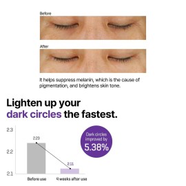 SOME BY MI Retinol Intense Advanced Triple Action Eye Cream - 1.01Oz, 30ml - Mild Korean Under Eye Cream Anti Aging for Dark Circles and Fine Lines - Ideal for Retinol Beginners - Korean Skin Care SOME BY MI Retinol Intense Advanced Triple Action Eye Cream - 1.01Oz, 30ml - Mild Korean Under Eye Cream Anti Aging for Dark Circles and Fine Lines - Ideal for Retinol Beginners - Korean Skin Care