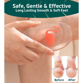 Sunivaca Glass Foot File Callus Remover for Feet, Flamingo Gifts for Women, Feet Scrubber Dead Skin Remover, Professional Pedicure Tools at Home, Heel Scraper for Cracked Heels Heavy Duty