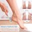 LINKEVAP Electric Callus Remover for Feet, Professional Pedicure Kit Foot Scrubber for Dry, Dead, Cracked, Hard Skin, at Home Feet Spa Care Kit for Men & Women (Cold White)