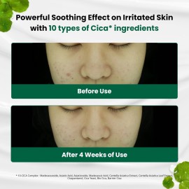 Dr.G Red Blemish Clear Soothing Korean Moisturizer Face Cream, 70ml - Cica Cream, Korean Skin Care Moisturizer, Korean Face Moisturizer, Facial Moisturizer, Korean Skincare, K Beauty Skincare Coreano Dr.G Red Blemish Clear Soothing Korean Moisturizer Face Cream, 70ml - Cica Cream, Korean Skin Care Moisturizer, Korean Face Moisturizer, Facial Moisturizer, Korean Skincare, K Beauty Skincare Coreano