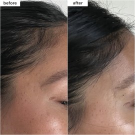 Briogeo Destined For Density MegaStrength+ Caffeine + Biotin Peptide Density Serum, Increases Hair Thickness and Volume, Fast-Absorbing & Non-Greasy, Fragrance-Free, Vegan, Cruelty-Free, 1.5 fl oz