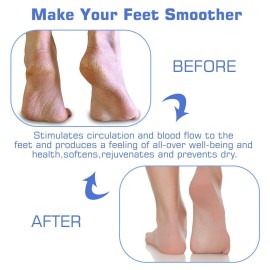 Shower Foot Scrubber Mat Back Washer Back Exfoliating Bath Wash Pad Wall Mounted Slip Suction Cups Foot Scrubber for Use in Shower Cups Foot Cleaner for Men and Women Shower Foot Scrubber Mat Back Washer Back Exfoliating Bath Wash Pad Wall Mounted Slip Suction Cups Foot Scrubber for Use in Shower Cups Foot Cleaner for Men and Women