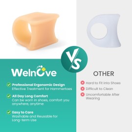 Welnove Hammertoe Corrector - 6 Pack Toe Splints - Soft Gel Toe Straighteners - Realign Bent, Curled, Crooked, Claw, Hammer Toes - Toe Corrector for Men and Women, 3 Different Sizes (Beige) Welnove Hammertoe Corrector - 6 Pack Toe Splints - Soft Gel Toe Straighteners - Realign Bent, Curled, Crooked, Claw, Hammer Toes - Toe Corrector for Men and Women, 3 Different Sizes (Beige)