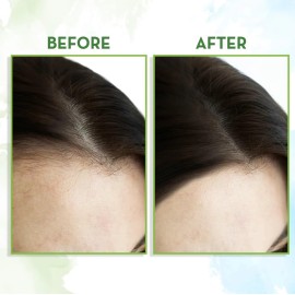 Mamaearth Pure & Natural Rosemary Essential Oil for Hair Growth | Strengthens Hair & Controls Hair Fall | Anti-Thinning Tonic | Suits All Hair Types | 0.51 Fl Oz/15 ml Mamaearth Pure & Natural Rosemary Essential Oil for Hair Growth | Strengthens Hair & Controls Hair Fall | Anti-Thinning Tonic | Suits All Hair Types | 0.51 Fl Oz/15 ml