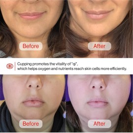 Rena Chris Facial Cupping Set & Gua Sha Facial Tool - Silicone Cupping Set & Rose Quartz Gua Sha Stone - Face Cupping Therapy Set for Natural Skin Care, Puffiness, Lip Plumping(Pink) Rena Chris Facial Cupping Set & Gua Sha Facial Tool - Silicone Cupping Set & Rose Quartz Gua Sha Stone - Face Cupping Therapy Set for Natural Skin Care, Puffiness, Lip Plumping(Pink)