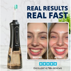 Puur Smile Professional Water Flosser - Advanced Dental Care for a Healthier Mouth, Gum, and Teeth - IPX7 Waterproof Oral Irrigator | 7 Replacement Tips, Travel-Friendly, Rechargeable - Oral Hygiene