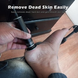 Upgraded Electric Callus Remover for Feet 1200RPM, Adjustable Speed Professional Electric Foot Sander Foot Grinder Heel File Pedicure Tool for Women Men Cracked Dead Skin, 60 Sandpaper Discs, Black Upgraded Electric Callus Remover for Feet 1200RPM, Adjustable Speed Professional Electric Foot Sander Foot Grinder Heel File Pedicure Tool for Women Men Cracked Dead Skin, 60 Sandpaper Discs, Black