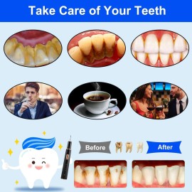 Plaque Remover for Teeth, Tartar Remover for Teeth Cleaning with 4 Replaceable Heads and 3 Adjustable Modes, Rechargeable Teeth Cleaning Plaque Remover for Home Plaque Remover for Teeth, Tartar Remover for Teeth Cleaning with 4 Replaceable Heads and 3 Adjustable Modes, Rechargeable Teeth Cleaning Plaque Remover for Home