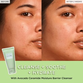 Glow Recipe Fruit Babies Skincare Kit - Gift Set with Ceramide Facial Cleanser + BHA Toner + Vitamin C Eye Cream + Hyaluronic Acid Cream + Niacinamide Dew Drops (5 Count) Glow Recipe Fruit Babies Skincare Kit - Gift Set with Ceramide Facial Cleanser + BHA Toner + Vitamin C Eye Cream + Hyaluronic Acid Cream + Niacinamide Dew Drops (5 Count)