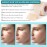 ARDAKI Scar Removal Tape Sheet Strips for C-Section, Acne Scars, Tummy Tuck, Keloid and Surgical Scars, Reusable Medical Grade Silicone Scar Tape