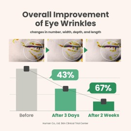 AXIS-Y Vegan Collagen Eye Serum - K Beauty Triple Hyaluronic Acid & Peptide Collagen Serum Improve Skin Elasticity, Reduce Fine Lines & Dark Circles - Vegan Korean Skin Care Eye Cream - 0.33 fl. oz. AXIS-Y Vegan Collagen Eye Serum - K Beauty Triple Hyaluronic Acid & Peptide Collagen Serum Improve Skin Elasticity, Reduce Fine Lines & Dark Circles - Vegan Korean Skin Care Eye Cream - 0.33 fl. oz.