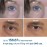 Dr.Melaxin Eyephalt Eyebag Cream for Puffiness, Dark Circles & Fine Lines, Wrinkle, EGF Anti-Aging Under Eye Moisturizer with Niacinamide&Ceramide 0.33 fl.oz.