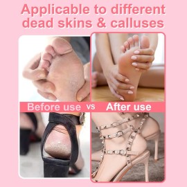 HayZBao Electric Foot File - Callus Remover for Feet,Professional Pedicure Tool for Dead Skin and Calluses,Adjustable Speed Foot File with 60 Pcs Sandpaper Discs - Pink HayZBao Electric Foot File - Callus Remover for Feet,Professional Pedicure Tool for Dead Skin and Calluses,Adjustable Speed Foot File with 60 Pcs Sandpaper Discs - Pink