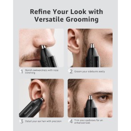 MANSPOT Nose & Ear Hair Trimmer for Men, 10000-RPM Electric Nose Trimmer for Men with Vacuum Cleaning System, IPX7 Waterproof, USB-C Charge, 90min Runtime,Magnetic Detachable Blade Head,Easy to Clean MANSPOT Nose & Ear Hair Trimmer for Men, 10000-RPM Electric Nose Trimmer for Men with Vacuum Cleaning System, IPX7 Waterproof, USB-C Charge, 90min Runtime,Magnetic Detachable Blade Head,Easy to Clean