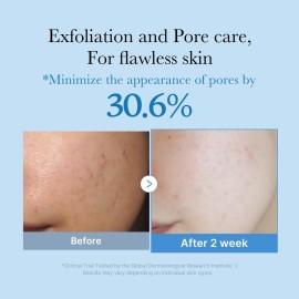 medicube Zero Pore Toner I Exfoliating & Hydrating Blue Bottle Water Toner with AHA, BHA, PHA, Niacinamide, and Panthenol | Korean Skin Care for Pores, Texture, and Moisture Care (8.45 fl. oz.) medicube Zero Pore Toner I Exfoliating & Hydrating Blue Bottle Water Toner with AHA, BHA, PHA, Niacinamide, and Panthenol | Korean Skin Care for Pores, Texture, and Moisture Care (8.45 fl. oz.)
