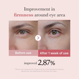 medicube Salmon DNA PDRN Pink Peptide Eye Serum with Niacinamide and 99% Purity Retinol for Fine Lines, Uneven Skin Tone, Korean Skin Care 1.01fl.oz medicube Salmon DNA PDRN Pink Peptide Eye Serum with Niacinamide and 99% Purity Retinol for Fine Lines, Uneven Skin Tone, Korean Skin Care 1.01fl.oz
