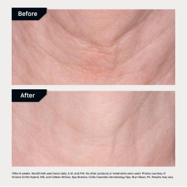 Revision Skincare Nectifirm, Anti Aging Neck Firming Cream for Reducing Fine Lines, Wrinkles and Crepey Skin, 1.7 oz