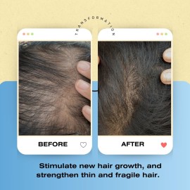 Therapro Mediceuticals Bioclenz AntiOxidant Shampoo - 8.45 oz