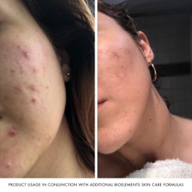 Bioelements Power Peptide - 6 fl oz - Age-Fighting Facial Toner for All Skin Types - Non Drying & Alcohol Free - Vegan, Gluten Free - Never Tested on Animals