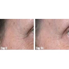 GOLDEN SERUM for Skin tightening, firming and sagging 20% Argireline, DMAE, APT (Red marine Algae), Pepha tight, Hyaluronic acid, Vitamin A (Retinol), Vitamin C, Syncoll PARABEN FREE 1 oz/30ml GOLDEN SERUM for Skin tightening, firming and sagging 20% Argireline, DMAE, APT (Red marine Algae), Pepha tight, Hyaluronic acid, Vitamin A (Retinol), Vitamin C, Syncoll PARABEN FREE 1 oz/30ml