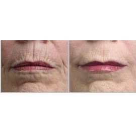 GOLDEN SERUM for Skin tightening, firming and sagging 20% Argireline, DMAE, APT (Red marine Algae), Pepha tight, Hyaluronic acid, Vitamin A (Retinol), Vitamin C, Syncoll PARABEN FREE 1 oz/30ml GOLDEN SERUM for Skin tightening, firming and sagging 20% Argireline, DMAE, APT (Red marine Algae), Pepha tight, Hyaluronic acid, Vitamin A (Retinol), Vitamin C, Syncoll PARABEN FREE 1 oz/30ml