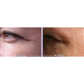 GOLDEN SERUM for Skin tightening, firming and sagging 20% Argireline, DMAE, APT (Red marine Algae), Pepha tight, Hyaluronic acid, Vitamin A (Retinol), Vitamin C, Syncoll PARABEN FREE 1 oz/30ml GOLDEN SERUM for Skin tightening, firming and sagging 20% Argireline, DMAE, APT (Red marine Algae), Pepha tight, Hyaluronic acid, Vitamin A (Retinol), Vitamin C, Syncoll PARABEN FREE 1 oz/30ml