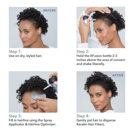 XFusion Keratin Hair Fibers - Medium Brown (15G) XFusion Keratin Hair Fibers - Medium Brown (15G)