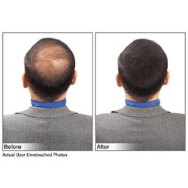 Hair Building Fibers Instantly Conceal Thinning Hair and Bald Spots for Men & Women (Large 28 Grams Bottle) - Undetectable, Washes Away, For All Hair Types, No Animal Byproducts (Medium Brown)