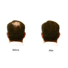 My Secret Correctives Hair Enhancer Spray for Fine or Thinning Hair - 5 oz each - 3 Cans - SILVER/GRAY