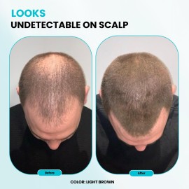 SURETHIK Building Hair Fibers to conceal thinning hair, Instantly Fuller Looking Hair for Men & Women, Auburn, 15g SURETHIK Building Hair Fibers to conceal thinning hair, Instantly Fuller Looking Hair for Men & Women, Auburn, 15g