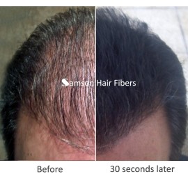 Samson Hair Fibers for Thinning Hair - 100% Undetectable Natural Formula - Completely Conceals Hair Loss in Seconds. Covers bald spots. Thicken your hair instantly - 25 Gram Container (BLACK)