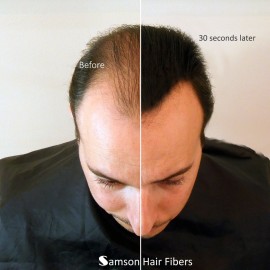 Samson Hair Fibers for Thinning Hair - 100% Undetectable Natural Formula - Completely Conceals Hair Loss in Seconds. Covers bald spots. Thicken your hair instantly - 25 Gram Container (BLACK)