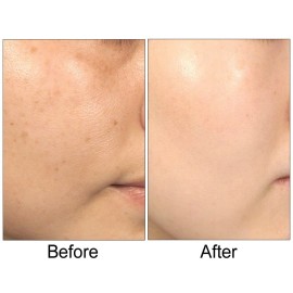 Biologic Solutions Lumetrics, 1 Ounce