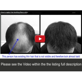 Samson Hair Fibers for Thinning Hair - 100% Undetectable Natural Formula - Completely Conceals Hair Loss in Seconds. Covers bald spots. Thicken your hair instantly - 25 Grams Refill (DARK GRAY)