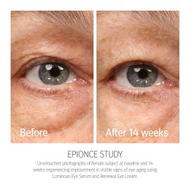 Epionce Renewal Eye Cream - Anti-Aging, Under Eye Cream for Dark Circles, Fine Lines, Wrinkles & Puffiness with Hyaluronic Acid, For All Skin Types, Dermatologist Skincare Epionce Renewal Eye Cream - Anti-Aging, Under Eye Cream for Dark Circles, Fine Lines, Wrinkles & Puffiness with Hyaluronic Acid, For All Skin Types, Dermatologist Skincare