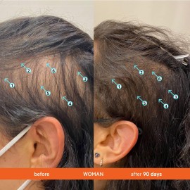 DS Labs Revita Shampoo - High-Performance Hair Density Shampoo, Volumizing & Thickening, Fuller, Healthier-Looking Hair, Sulfate & Silicone Free, For Men & Women, 205mL (Pack of 2) DS Labs Revita Shampoo - High-Performance Hair Density Shampoo, Volumizing & Thickening, Fuller, Healthier-Looking Hair, Sulfate & Silicone Free, For Men & Women, 205mL (Pack of 2)