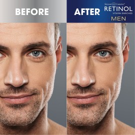 Retinol Mens Eye Cream - The Original Retinol Eye Treatment For Men - Targets Under-Eye Area to Reduce Puffiness & Dark Circles, Boost Hydration & Drastically Minimize the Visible Signs Of Aging
