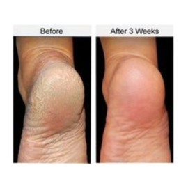 Secret of the Islands - Coconut Body Butter