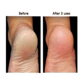 Secrets of the Islands - Key Lime Salt Scrub 16 oz