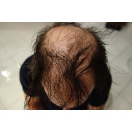 Hair Building Fibers - Red 50 Gram Refill for Existing Bottle - Hair Filler Concealer for Grey Roots by Finally Hair