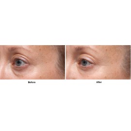 Dr Dennis Gross Ferulic + Retinol Triple Correction Eye Serum: for Wrinkles, Loss of Elasticity, and Rough Texture, 0.5 fl oz Dr Dennis Gross Ferulic + Retinol Triple Correction Eye Serum: for Wrinkles, Loss of Elasticity, and Rough Texture, 0.5 fl oz