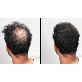 LUXE Hair Thickening Fibers - CONFIDENCE IN A JAR - 2 Months+ Supply! - Hypoallergenic, Dermatologist Tested - Multiple Colors Available (Medium Brown) LUXE Hair Thickening Fibers - CONFIDENCE IN A JAR - 2 Months+ Supply! - Hypoallergenic, Dermatologist Tested - Multiple Colors Available (Medium Brown)