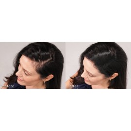 LUXE Hair Thickening Fibers - CONFIDENCE IN A JAR - 2 Months+ Supply! - Hypoallergenic, Dermatologist Tested - Multiple Colors Available (Medium Brown) LUXE Hair Thickening Fibers - CONFIDENCE IN A JAR - 2 Months+ Supply! - Hypoallergenic, Dermatologist Tested - Multiple Colors Available (Medium Brown)