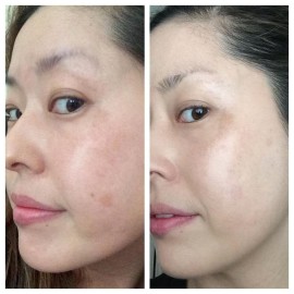 DNA Code- 20% Glycolic Acid Complex Skin Renewal Moisturizer w/Retinol, CoQ10, B5 and More