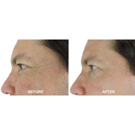 DNA Code- 20% Glycolic Acid Complex Skin Renewal Moisturizer w/Retinol, CoQ10, B5 and More