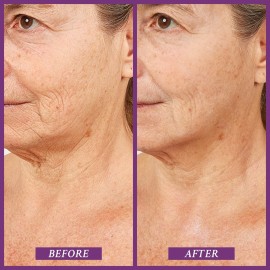 PRAI Beauty Ageless Throat & Decolletage Serum for Instantly Ageless Neck | Neck Firming and Tightening Serum | Anti-Aging Serum that Shields Skin from Damage and Improves Skin Tone + Colour | 4 Oz