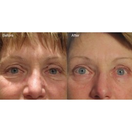 DNA Code- Swiss Apple Stem Cell moisturizer w/Argireline, Matrixyl 3000, Hyaluronic Acid, CoQ10